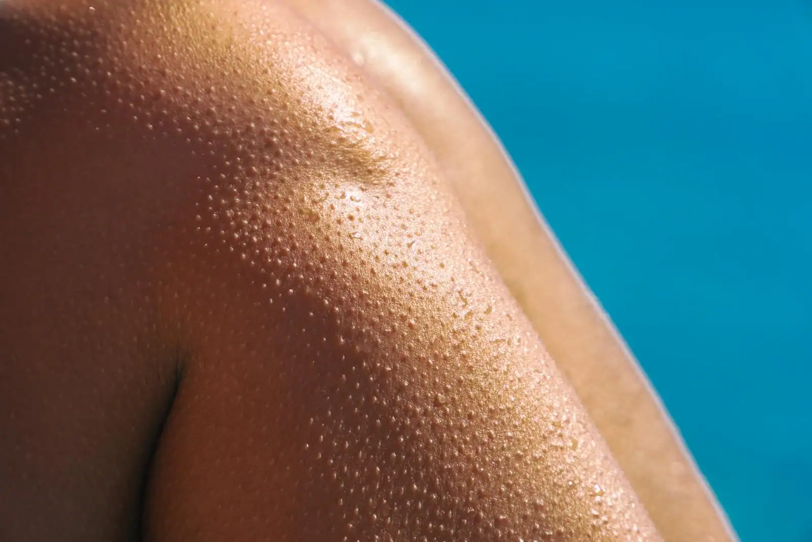 Peau humaine en gros plan, lumière naturelle, soin estival, ambiance éditoriale santé