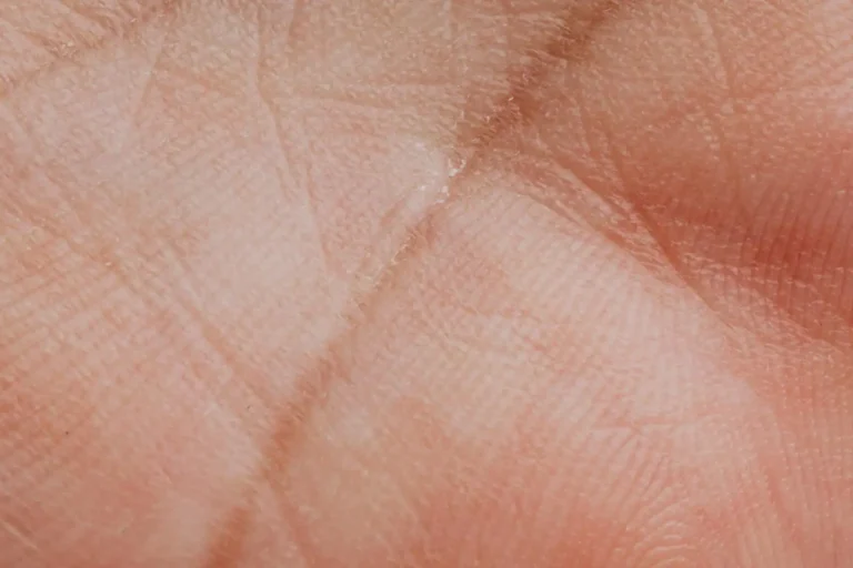 Lignes de la main : ce qu&rsquo;elles disent dans la tradition, ce qu&rsquo;elles ne prouvent pas