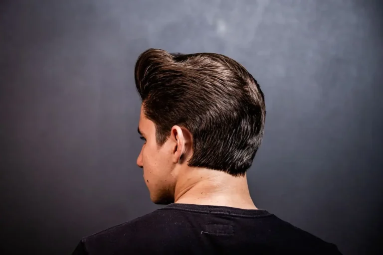 Cheveux implants