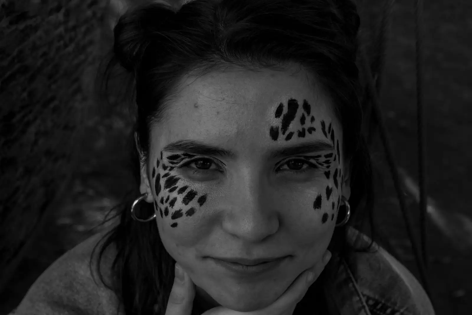 Portrait en noir et blanc d'une femme dont la tempe et la pommette portent des taches façon léopard.